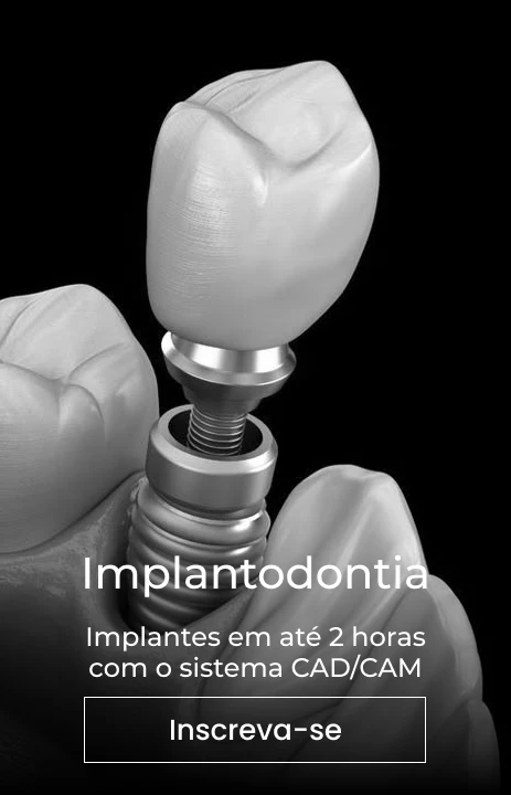 tratamentos_salute_implantodontia_bruno_conzi