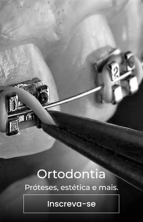 tratamentos_salute_ortodontia_bruno_conzi